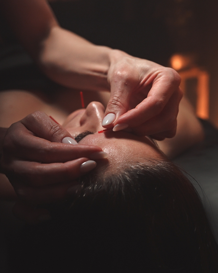 Acupuntura + Ritual Canalizado y Sanación